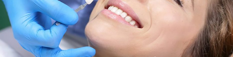 brighten up your smile with teeth whitening in edmonton