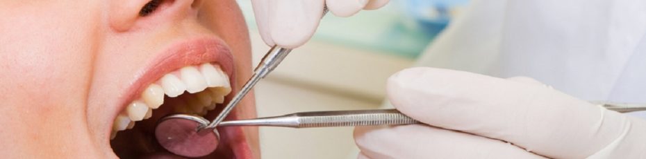 5 reasons why you should consider tooth extractions