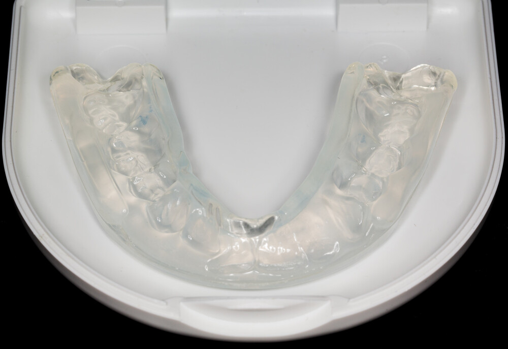 The Benefits of Wearing a Custom Mouth Guard at Night - Albany Dental