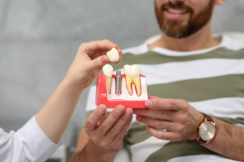 4 reasons why should you choose dental implants